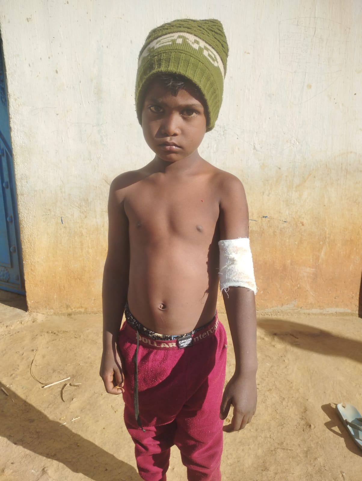 जंगली सियार ने अचानक पांच साल के बच्चे पर किया हमला