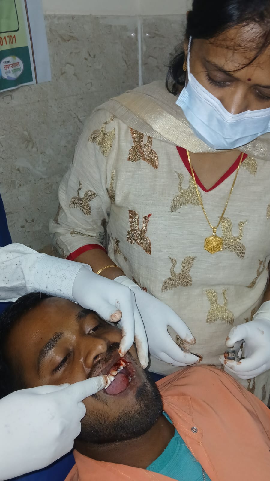सदर अस्पताल बोकारो में फंसे दांत का सफल ऑपरेशन